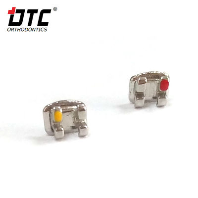 Οι μεταλλικές αγκάλες της σειράς DTC Bright είναι το κλειδί για την επιτυχή ορθοδοντική θεραπεία κατηγορίας II